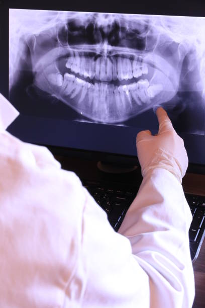 Best Mobile Emergency Dentist in Culver, IN