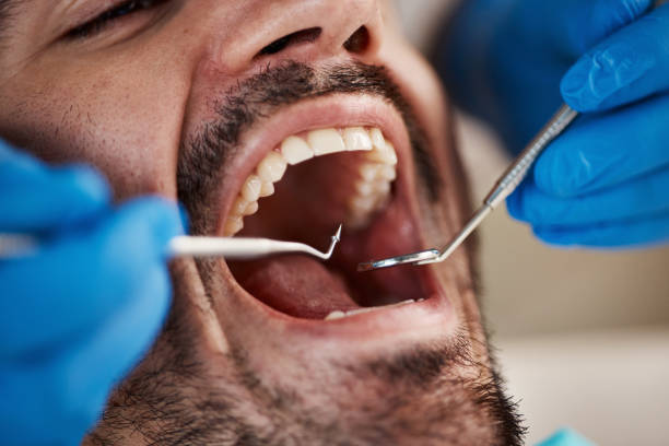 Best Emergency Dentist for Special Needs Patients in Culver, IN