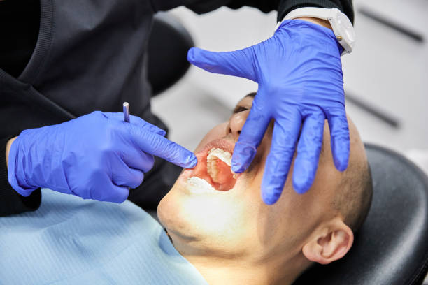 Best Emergency Dental Services for Seniors in Culver, IN
