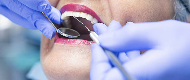 Best Orthodontic Emergency Dentist in Culver, IN